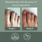 The H-Nail Rescue Pen® (3ml)